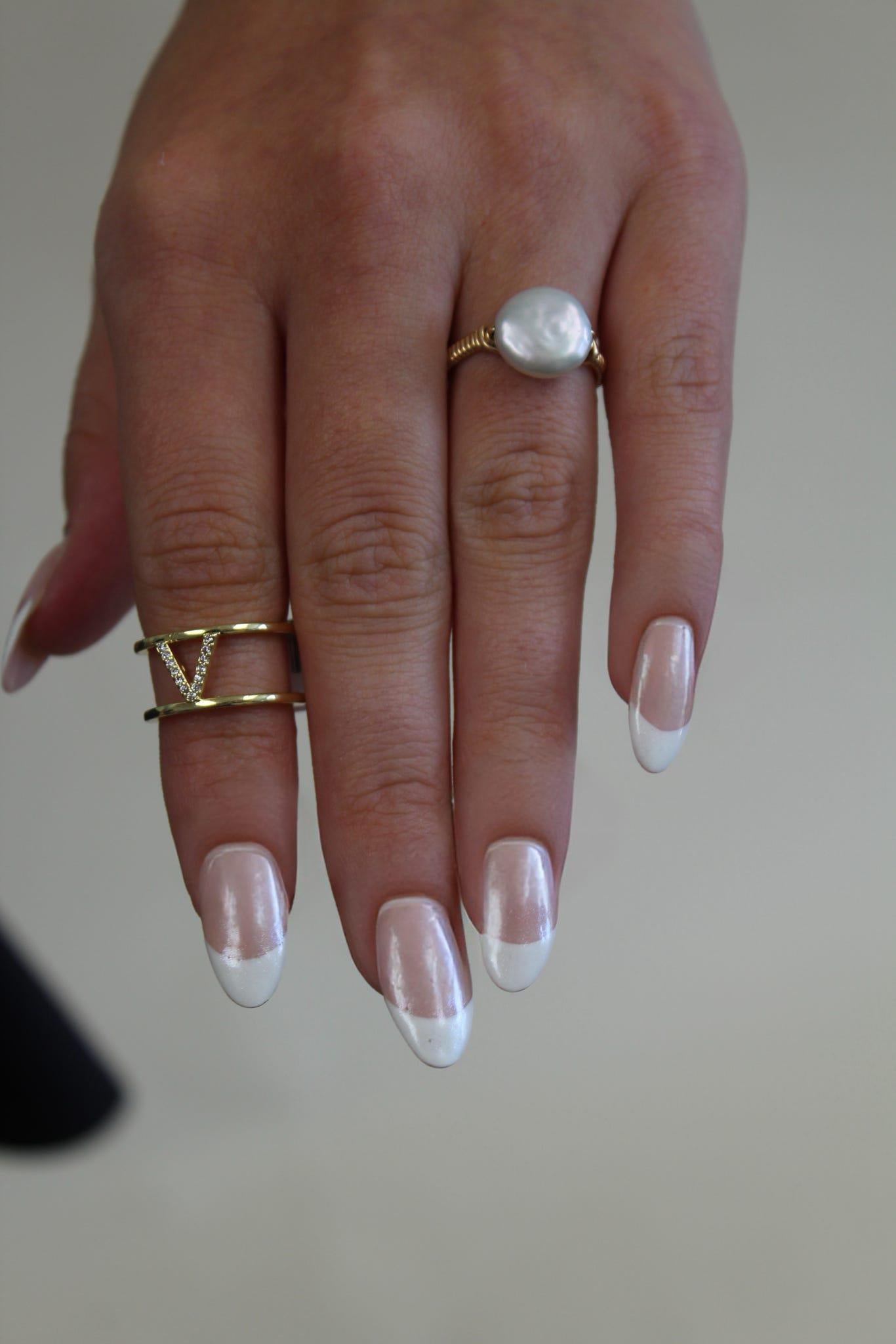 Double Band Initial Ring